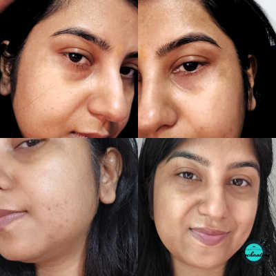 A four-panel comparison collage showcasing skin results after using YLW (You're Looking Well) Day and Night creams. The images include close-up shots highlighting skin texture and a final full-face portrait demonstrating a hydrated, glowing complexion.